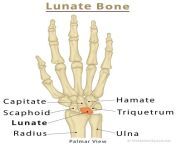 lunate bone.jpg from lunat