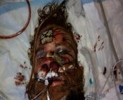 kelly thomas police beating.jpg from extremely graphic autopsy of a gi