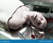 cadaver dead male body morgue steel table corpse autopsy concept d rendering 88638613.jpg from autopsy footage on dead women recorded by medical student