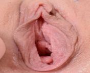 146 1000.jpg from feamale pussy vagina close up pics