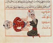 charaf ed dinoperation for castration 1466.jpg from eunuch castrates balls