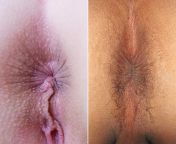 640px female and male anus.jpg from anal opened