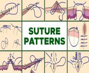 2250 suture patterns.jpg from sutrie