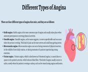 different types of angina.png from anjina