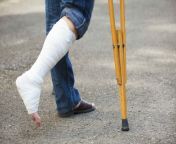 ankle knee injury missouri workers comp lawyer.jpg from leg workers