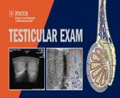 testicular infographic 1200x628.jpg from testicular ixam