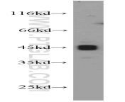 pawr antibody 20688 1 ap p112299wb.jpg from parwr