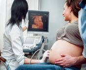doctor and patient ultrasound equipment diagnostics sonography machine ramasets.jpg.jpg from pregnancy mein ultrasound doctor kaise karte hain film