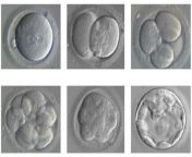 下载 1.jpg from 曼曼美国冻卵 薇信gz020r 囊胚移植还是胚胎移植好 圆镜子助孕 做试管的成功率能有多少 薇信gz020r 河北三亲婴儿7gw