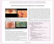 vulvaerkrankungen beim maedchen im kindesalter pdf 3 1024x1448.png from chil vagina