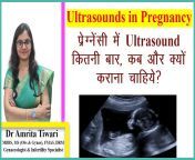maxresdefault.jpg from pregnancy mein ultrasound doctor kaise karte hain film
