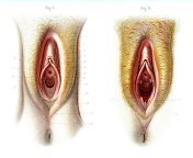 1 virgin and non virgin vulva anatomy collection abecasis.jpg from vigern