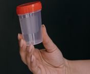 specimen container.jpg from semen sample
