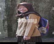 an albino person named dewi rasmana seen going to school in ciburuy village garut west java on november 4 2019 people with albino in ciburuy village can live normally with other communities photo by bella desi deria ina photo agency sipa usa 2ep68gr.jpg from www bangla move অপু সাহারা xxx photo comihar samasn village women sexy bathing video 3gp my porn wep com pregnent and baby born 3gp xxx com
