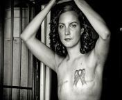2d274905761921 4 breast cancer scar projec.jpg from nude breast cancer