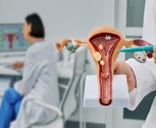 vaginal cysts.jpg from doctor vulva