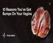 10 reasons you have got bumps on your vagina 1 1024x536.jpg from vagina