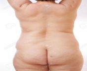 146104187 legs and back of a 40 year old woman with stretch marks cellulite and excess weight on a white.jpg from old granny ass