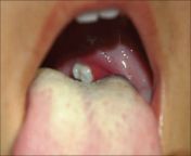 main qimg 68cf5087f01e59af4be35197c0d8af13 lq from uvula teeth
