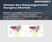 global sex reassignment surgery market.jpg from market sex