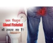 anal fistula in hindi jpegimpolicymedium widthonlyw300 from गुदा महिला पुरूष पुरूष त्