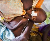 sudan breast feeding jpgwidth1200height1200fitcrop from south sudan tits