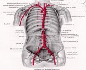 aorta aortic artery aneurysm anatomy location 768x891.gif from wwwaorata
