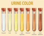 urine color 01 scaled.jpg from urine d