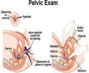 pelvic exam.jpg from gyno pelece exam