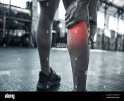 pain in the calf from injury hurts hands of trainer touching their leg in pain bodybuilder with cgi pain in their leg closeup on hand of athlete wi 2pw6ypd.jpg from leg wi