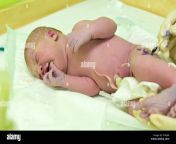 newborn baby girl right after delivery c06j9a.jpg from 10 baby girl sax 3gp medical delivery 3gpxx comजीजा और साली की चुदाई की विडियो हिन्दी