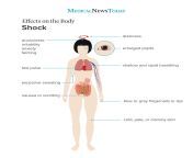 an infographic of effects on the body shock.jpg from shock to see