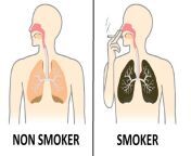 differnenc between smokers and non smokers 1024x576.png from non smoker is trying to smoke for money